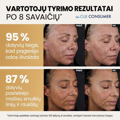 Swedish Nutra Marine Collagen 15 000 mg – gamintojo tyrimo nuotraukos prieš ir po 8 savaičių, 95 % ir 87 % dalyvių rezultatai